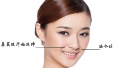 成都去抬头纹大概需要多少钱？怎样有去除抬头纹？