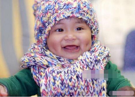 酒窝成形术的适合人群有哪些?整个酒窝要注意些什么?