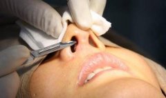 硅胶假体取出的过程降低风险吗?术后注意事项有哪些?