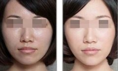 黑脸娃娃适合人群 做黑脸娃娃成好吗
