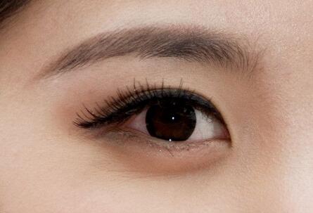 双眼皮失败修复手术注意事项有哪些？