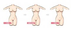 附乳祛除价格是多少钱 附乳祛除价格是多少钱