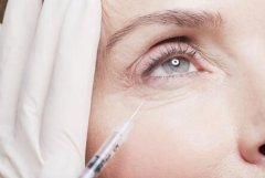 哪些方法除眼角皱纹比较有？