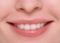牙齿种植和烤瓷牙之间的区别是什么?