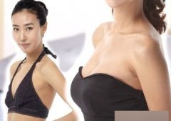 曼托假体隆胸手术降低风险吗、成好吗