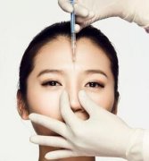 玻尿酸隆鼻靠谱吗？价格大概是多少？