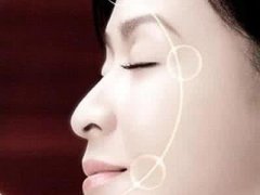 电波l皮除皱手术有什么特点