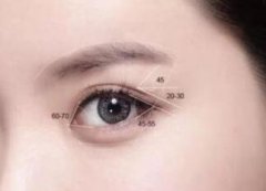 埋线双眼皮多少钱呢