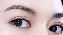 西安女子整形医院埋线双眼皮介绍