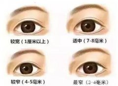 整形专家介绍：双眼皮修复都有哪些原因？
