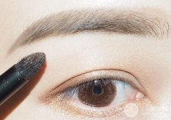 埋线双眼皮手术修复医院哪家好