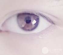 做双眼皮果怎么样