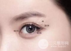 哪些眼睛适合做双眼皮