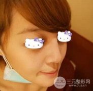 注射隆鼻好不好 优势有哪些 为什么那么多人喜欢？