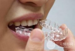 听说牙齿矫正的价格很贵，是真的吗？
