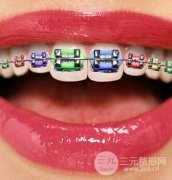 我都“奔三”了，还可以做牙齿矫正吗？