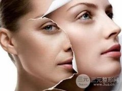 微创除皱，让你重获年轻美丽！