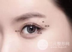 眼部双眼皮整形矫正术后如何护理？