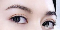 眼部整形韩式微创双眼皮果好不好?