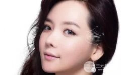 双眼皮失败修复术能够针对哪些失败问题修复呢?