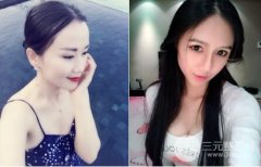假体隆胸切口在哪里，会留疤吗