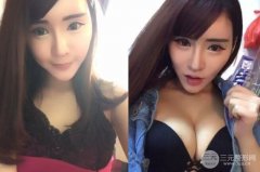 假体隆胸的手感像真胸吗，会不会摸出假体