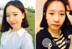 鼻子立体感不强该怎么办