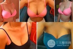 假体隆胸术要注意什么