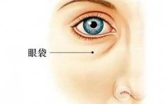 手术去眼袋果好不 手术去眼袋果好不