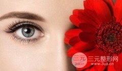 激光缓解眼袋原理 激光缓解眼袋原理