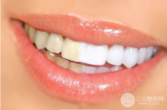 牙黄怎么办？洗牙可以美白牙齿吗？洗牙和牙齿美白一样吗？