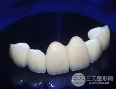 二氧化锆全瓷牙修复果怎么样？