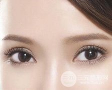 割双眼皮的合适年龄是多少岁？