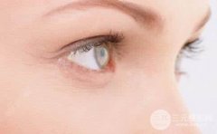 面部美容注射去鱼尾纹果怎么样