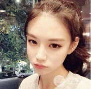 自体脂肪丰耳垂果好不好呢