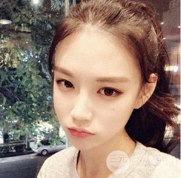 自体脂肪丰耳垂果好不好呢