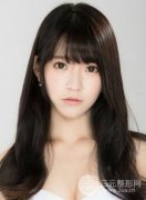 垫下巴失败后多久能修复 垫下巴失败后多久能修复