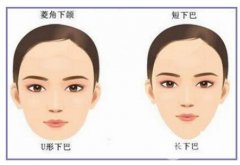 下颌角整形术后会不会出现后遗症？