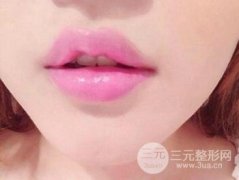 自体脂肪丰唇要多少钱?价格一般是多少? 自体脂肪丰唇要多少钱?价格一般是多少?