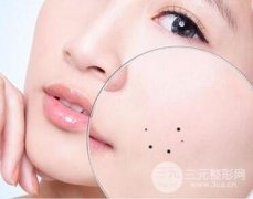 街头点痣不靠谱，得去正规医院！