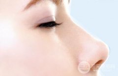 假体隆鼻手术全过程分享 假体隆鼻手术全过程分享