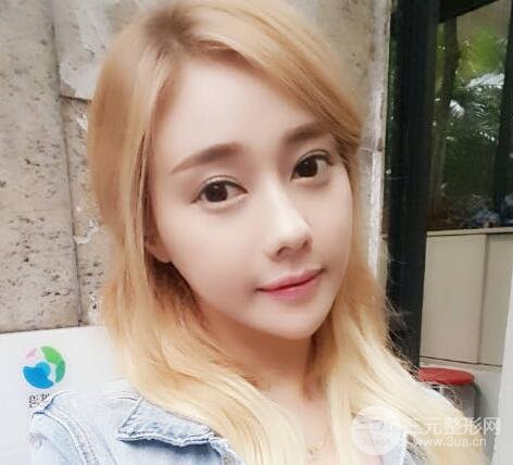 隆鼻后恢复过程是怎样的