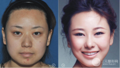 彩光嫩肤可以解决皮肤的多种问题