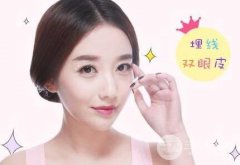 做埋线双眼皮哪家医院靠谱？