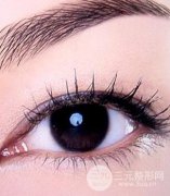 埋线双眼皮手术过程需要多久？具体是怎样的？