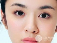 吸脂祛眼袋会不会反弹? 吸脂祛眼袋会不会反弹?