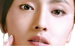 哪种隆鼻材料比较好?怎么选择? 哪种隆鼻材料比较好?怎么选择?
