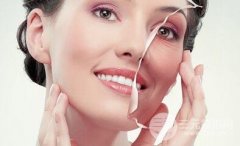 电波l皮三大优点 可保持五年