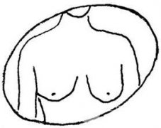 乳房不对称怎么办,可以矫正吗,果好不好 乳房不对称怎么办,可以矫正吗,果好不好