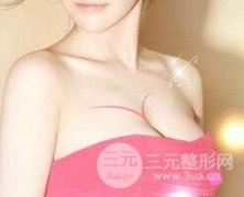 你的身体状况适合自体脂肪丰胸吗